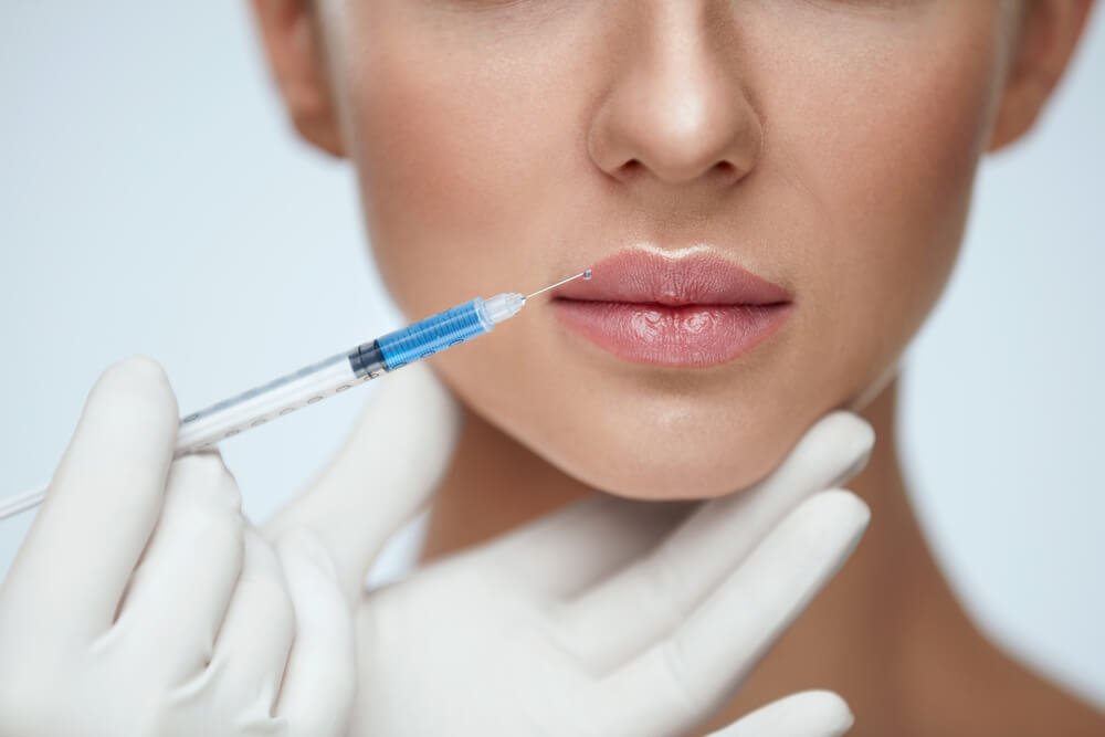 Is Lip Augmentation Safe?